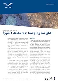 type 1 diabetes imaging insight type 1 diabetes imaging insight