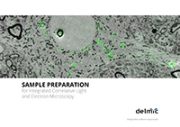 Sample preparation for correlative light and electron microscopy Sample preparation for correlative light and electron microscopy
